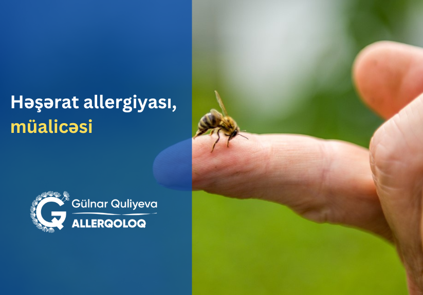 Böcək (Həşərat) allergiyası müalicəsi