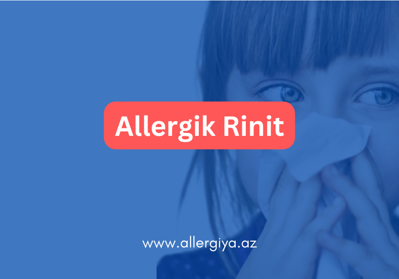 Allergik rinitin nədir və əlamətləri hansılardır?